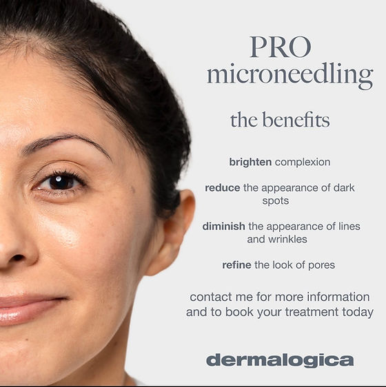 What Is Microneedling And What Are Its Benefits?
